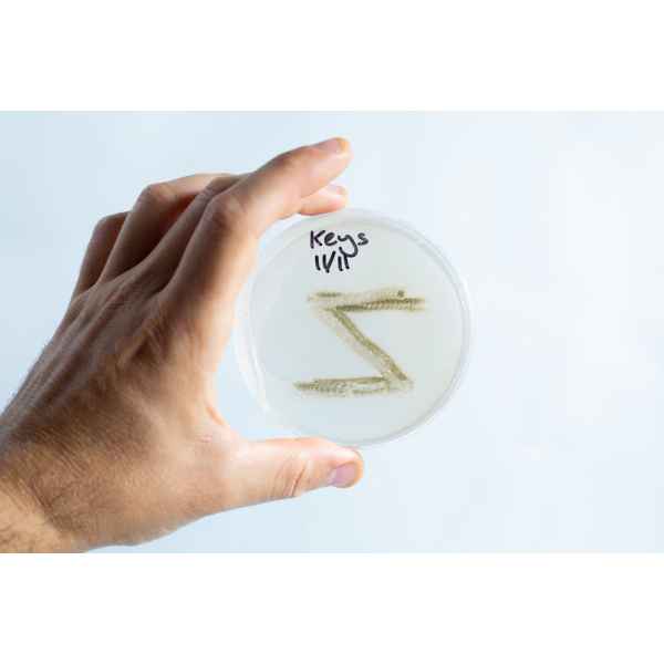 Agar petri dish MEA School Science Fun Project - Contaminated plate